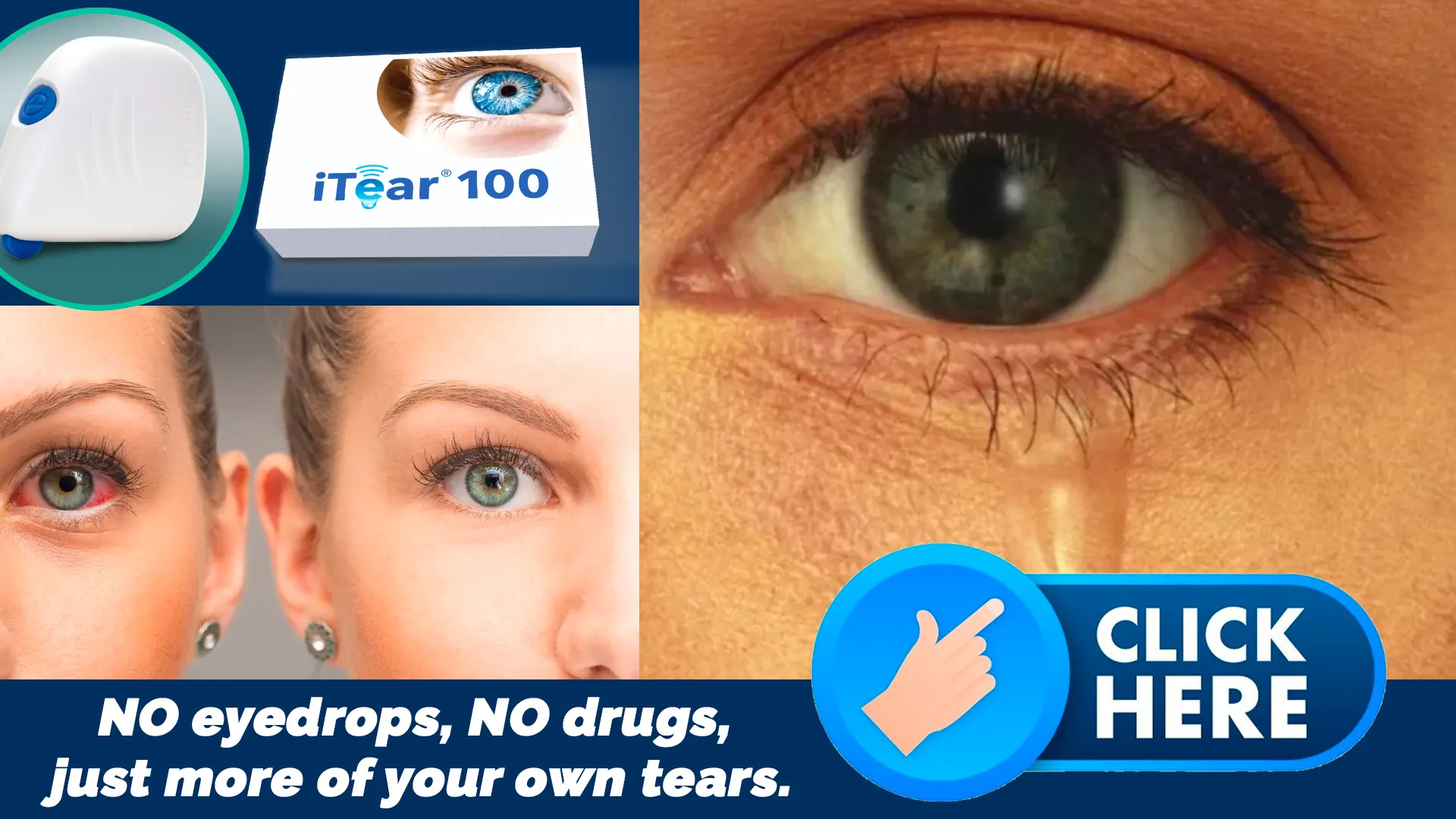 A Drug-Free Solution: The iTEAR100 Device